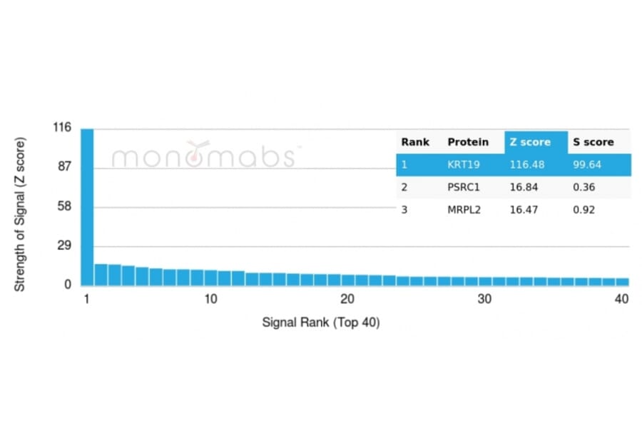 Protein Array - Anti-Cytokeratin 19 Antibody [rKRT19/799] (A249206) - Antibodies.com