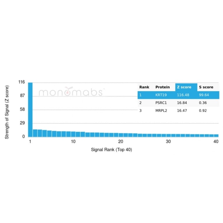 Protein Array - Anti-Cytokeratin 19 Antibody [rKRT19/799] (A249206) - Antibodies.com