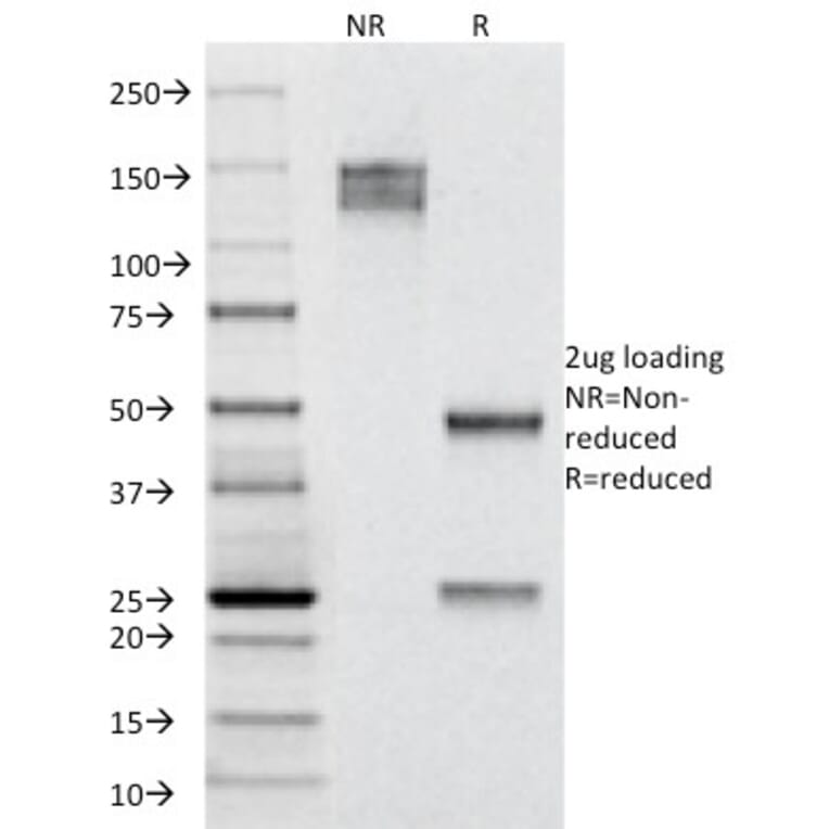 SDS-PAGE - Anti-Cytokeratin 19 Antibody [A53-B/A2.26] (A249208) - Antibodies.com