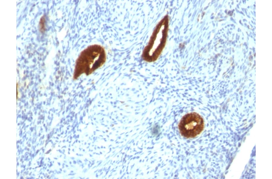 Immunohistochemistry - Anti-Cytokeratin 19 Antibody [SPM266] (A249209) - Antibodies.com