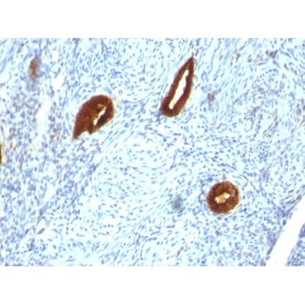 Immunohistochemistry - Anti-Cytokeratin 19 Antibody [SPM266] (A249209) - Antibodies.com
