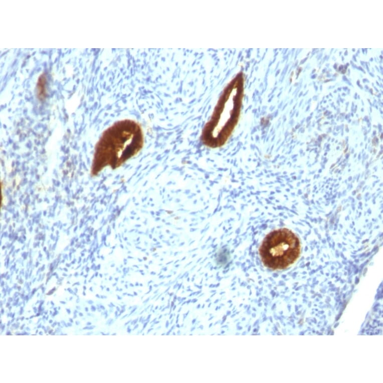 Immunohistochemistry - Anti-Cytokeratin 19 Antibody [SPM266] (A249209) - Antibodies.com
