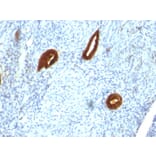 Immunohistochemistry - Anti-Cytokeratin 19 Antibody [SPM266] (A249209) - Antibodies.com