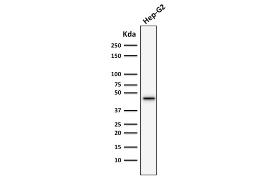 Western Blot - Anti-Cytokeratin 19 Antibody [SPM266] (A249209) - Antibodies.com