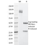 SDS-PAGE - Anti-Cytokeratin 19 Antibody [SPM266] (A249209) - Antibodies.com
