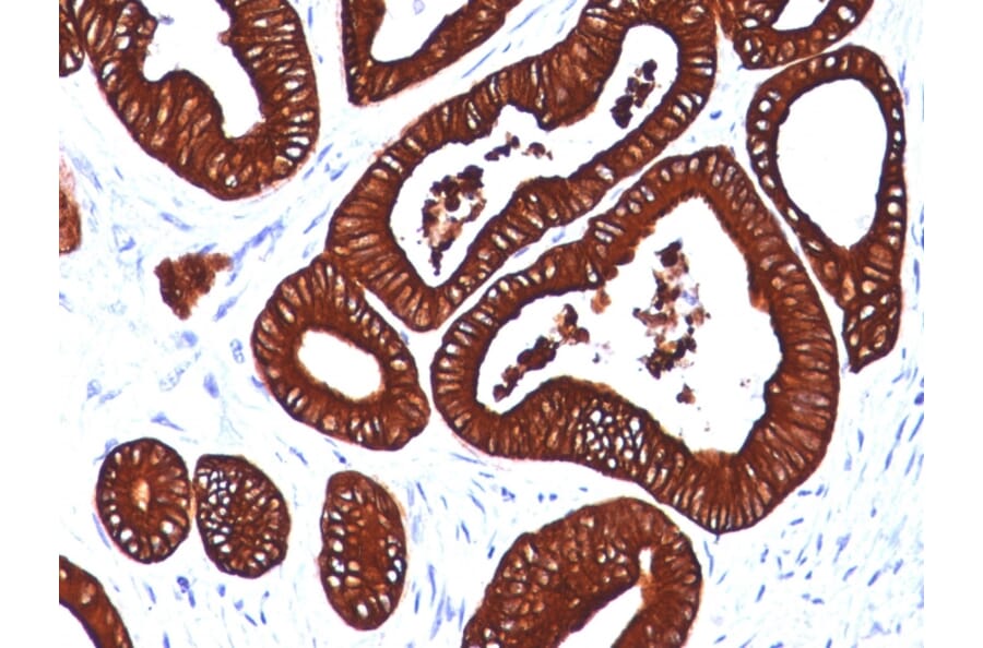 Immunohistochemistry - Anti-Cytokeratin 19 Antibody [BA17] (A249210) - Antibodies.com