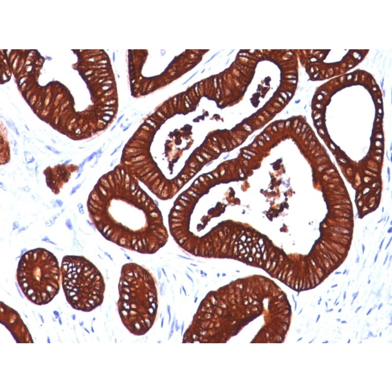 Immunohistochemistry - Anti-Cytokeratin 19 Antibody [BA17] (A249210) - Antibodies.com