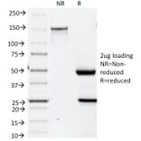 SDS-PAGE - Anti-Cytokeratin 19 Antibody [BA17] (A249210) - Antibodies.com