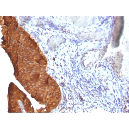 Immunohistochemistry - Anti-Cytokeratin 19 Antibody [SPM561] (A249211) - Antibodies.com