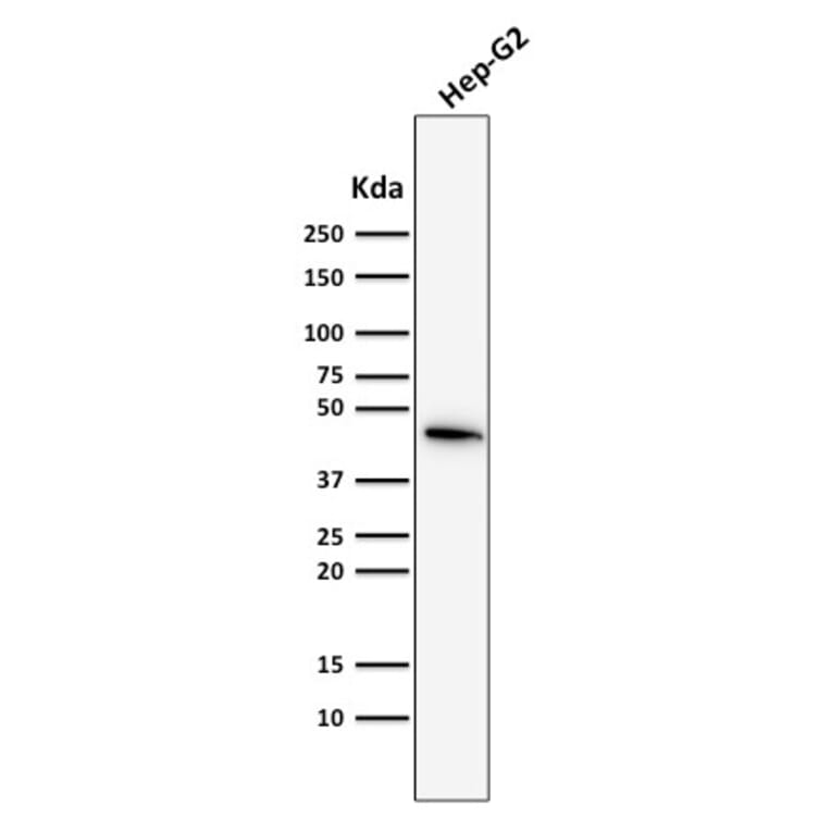 Western Blot - Anti-Cytokeratin 19 Antibody [SPM561] (A249211) - Antibodies.com