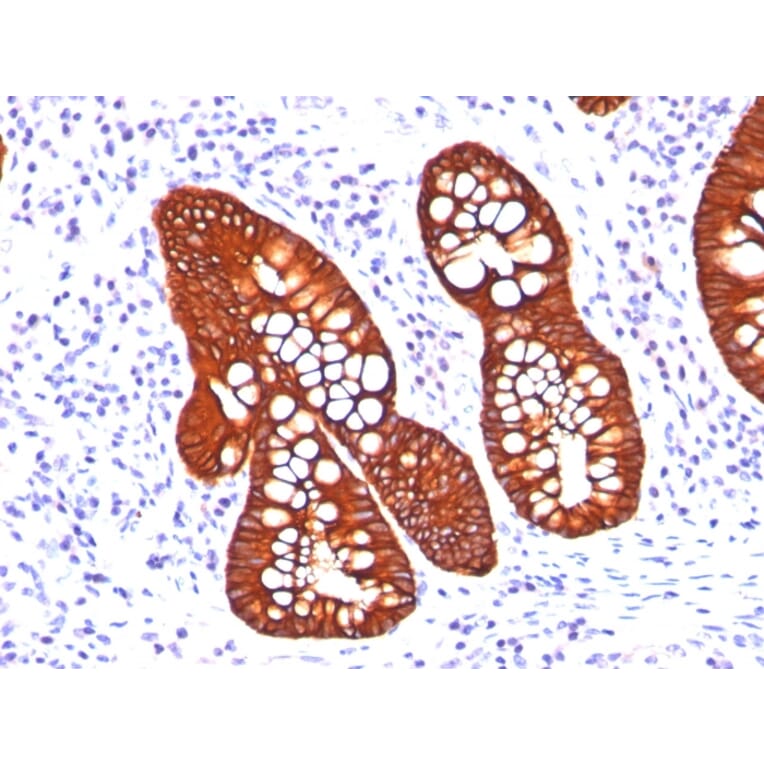 Immunohistochemistry - Anti-Cytokeratin 19 Antibody [A53-B/A2.26 + BA17] (A249211) - Antibodies.com