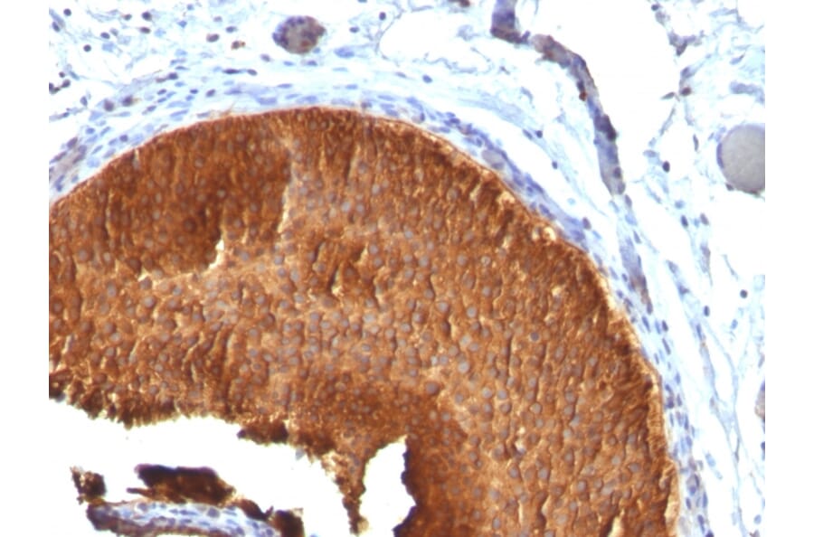 Immunohistochemistry - Anti-Cytokeratin 19 Antibody [KRT19/799] (A249213) - Antibodies.com