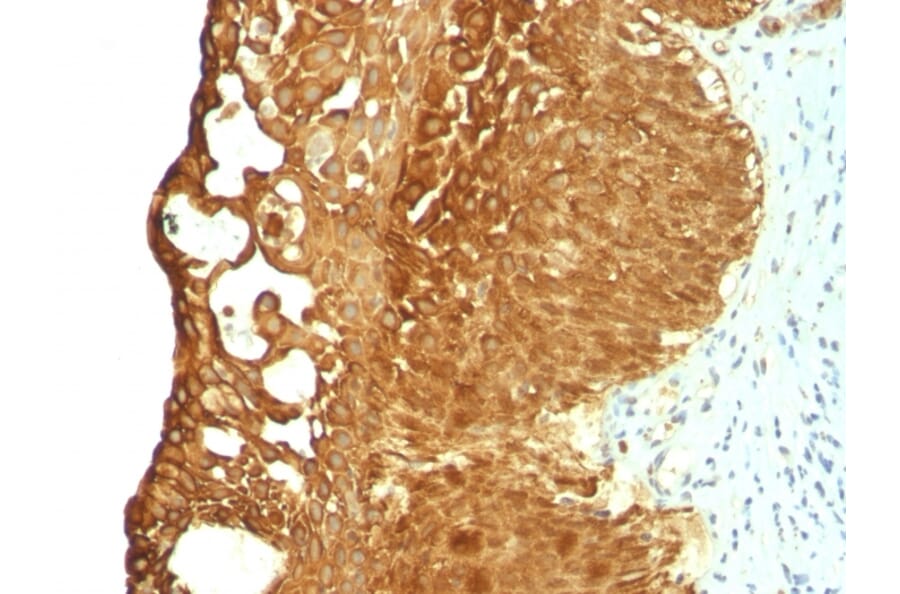 Immunohistochemistry - Anti-Cytokeratin 19 Antibody [KRT19/799] (A249213) - Antibodies.com
