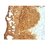 Immunohistochemistry - Anti-Cytokeratin 19 Antibody [KRT19/799] (A249213) - Antibodies.com