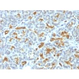 Immunohistochemistry - Anti-Cytokeratin 19 Antibody [KRT19/799] (A249213) - Antibodies.com