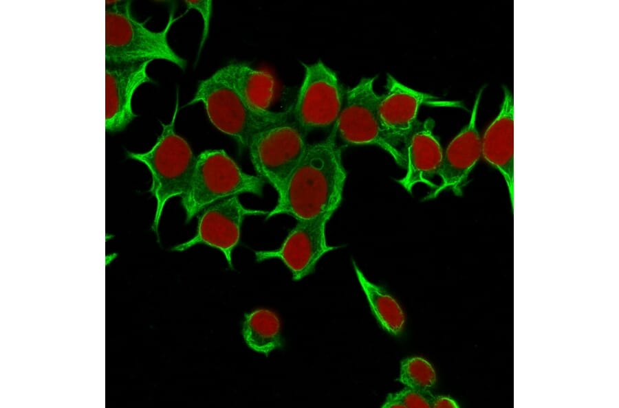Immunofluorescence - Anti-Cytokeratin 19 Antibody [KRT19/799] (A249213) - Antibodies.com