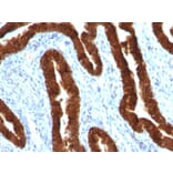 Immunohistochemistry - Anti-Cytokeratin 19 Antibody [KRT19/800] (A249214) - Antibodies.com