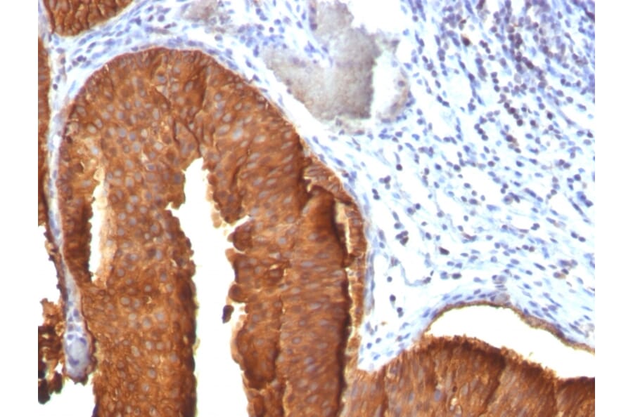 Immunohistochemistry - Anti-Cytokeratin 19 Antibody [KRT19/800] (A249214) - Antibodies.com