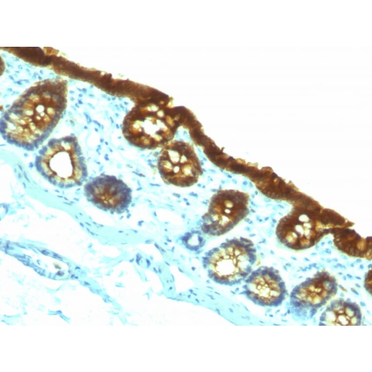 Immunohistochemistry - Anti-Cytokeratin 19 Antibody [KRT19/800] (A249214) - Antibodies.com