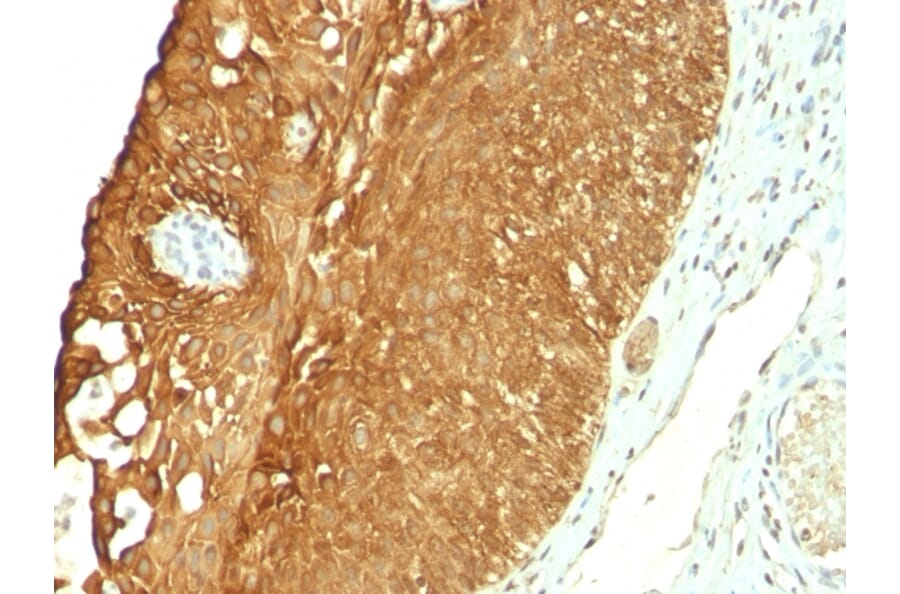 Immunohistochemistry - Anti-Cytokeratin 19 Antibody [KRT19/800] (A249214) - Antibodies.com