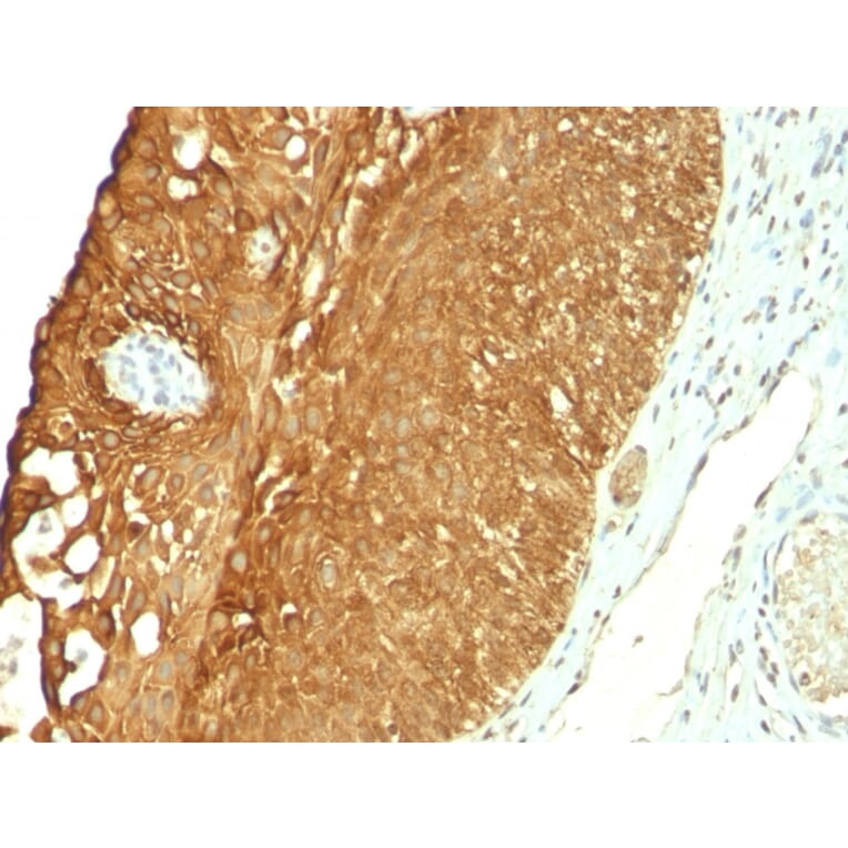 Immunohistochemistry - Anti-Cytokeratin 19 Antibody [KRT19/800] (A249214) - Antibodies.com