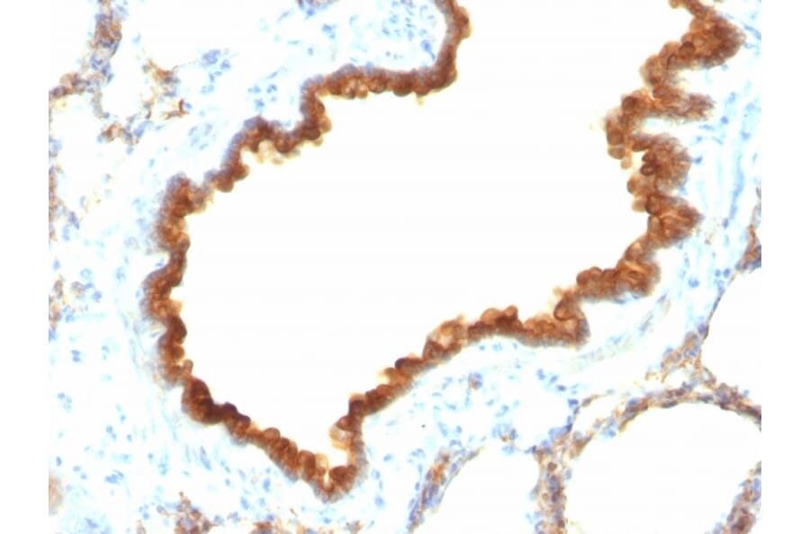 Immunohistochemistry - Anti-Cytokeratin 19 Antibody [KRT19/800] (A249214) - Antibodies.com