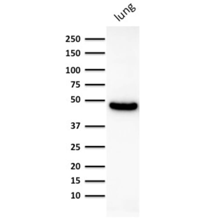 Western Blot - Anti-Cytokeratin 19 Antibody [KRT19/800] (A249214) - Antibodies.com