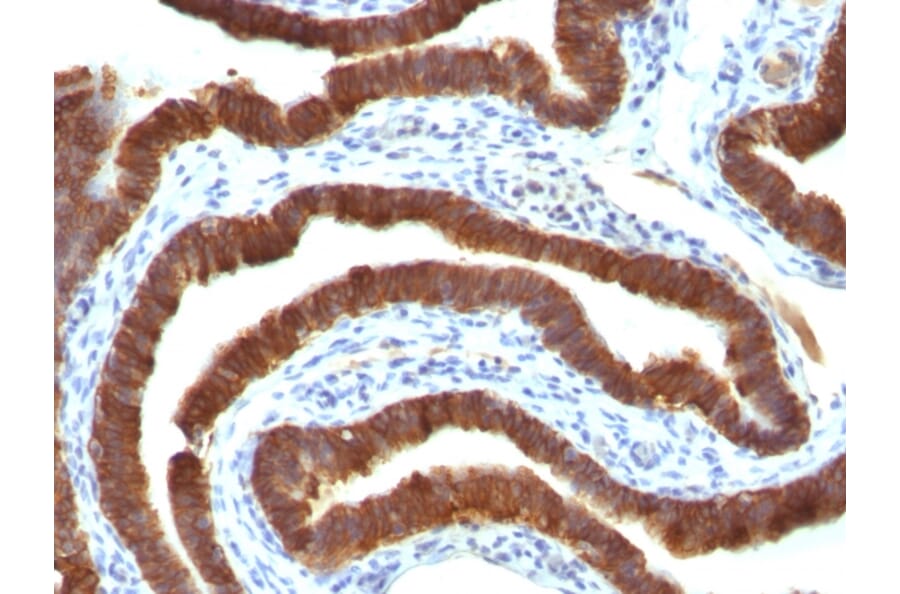 Immunohistochemistry - Anti-Cytokeratin 19 Antibody [Ks19.1] (A249215) - Antibodies.com
