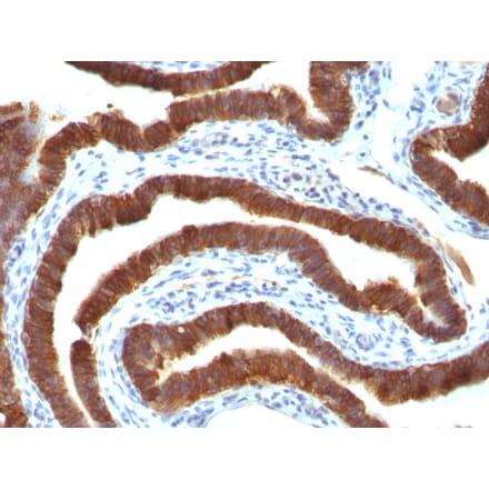 Immunohistochemistry - Anti-Cytokeratin 19 Antibody [Ks19.1] (A249215) - Antibodies.com