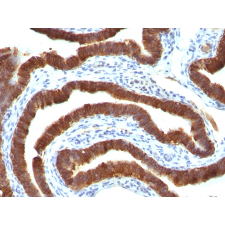 Immunohistochemistry - Anti-Cytokeratin 19 Antibody [Ks19.1] (A249215) - Antibodies.com