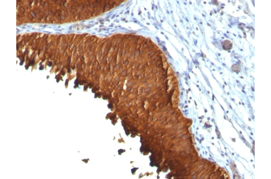 Immunohistochemistry - Anti-Cytokeratin 19 Antibody [KRT19/799 + KRT19/800] (A249215) - Antibodies.com