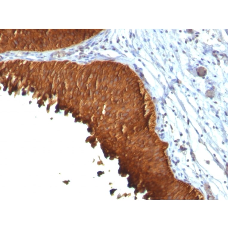 Immunohistochemistry - Anti-Cytokeratin 19 Antibody [KRT19/799 + KRT19/800] (A249215) - Antibodies.com
