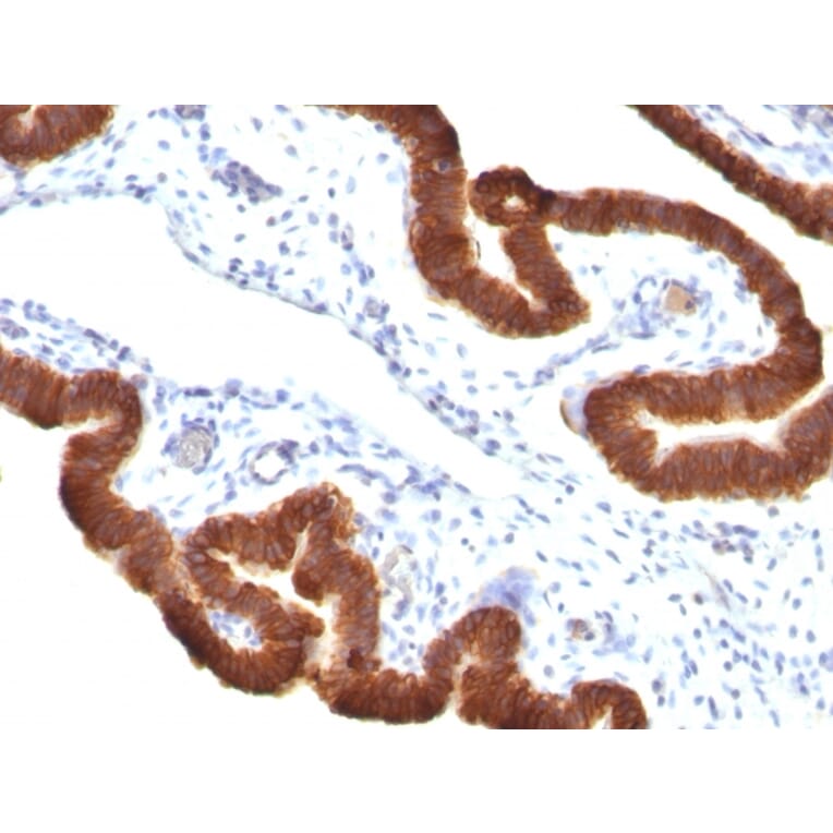 Immunohistochemistry - Anti-Cytokeratin 19 Antibody [KRT19/799 + KRT19/800] (A249216) - Antibodies.com