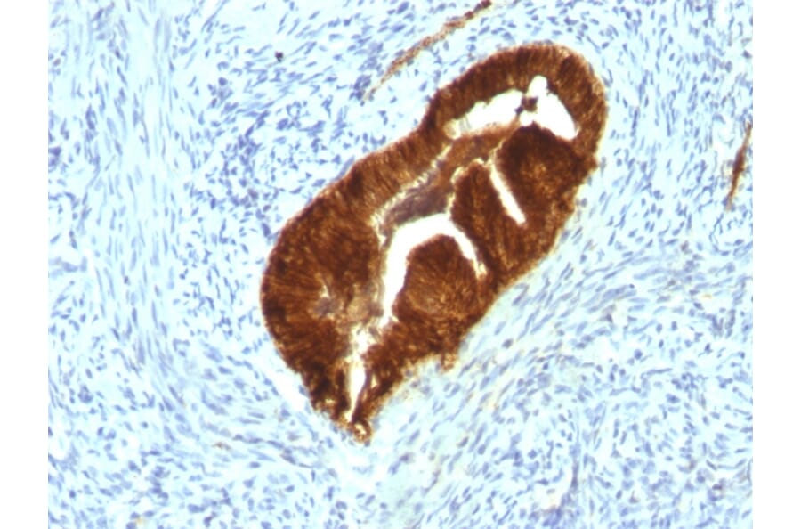 Immunohistochemistry - Anti-Cytokeratin 19 Antibody [KRT19/799 + KRT19/800] (A249216) - Antibodies.com