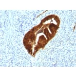 Immunohistochemistry - Anti-Cytokeratin 19 Antibody [KRT19/799 + KRT19/800] (A249216) - Antibodies.com