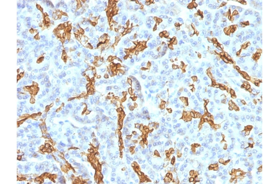 Immunohistochemistry - Anti-Cytokeratin 19 Antibody [KRT19/799 + KRT19/800] (A249216) - Antibodies.com
