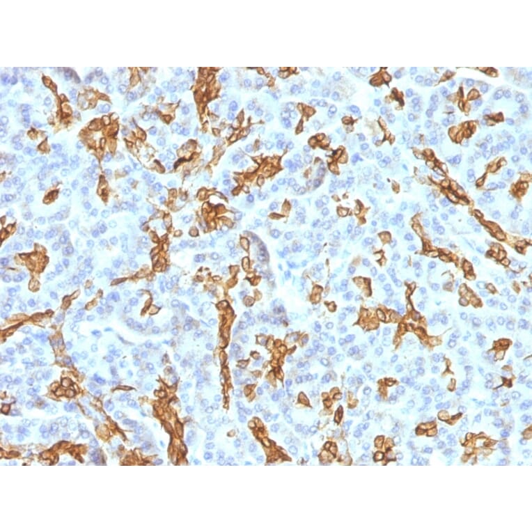 Immunohistochemistry - Anti-Cytokeratin 19 Antibody [KRT19/799 + KRT19/800] (A249216) - Antibodies.com