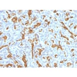 Immunohistochemistry - Anti-Cytokeratin 19 Antibody [KRT19/799 + KRT19/800] (A249216) - Antibodies.com