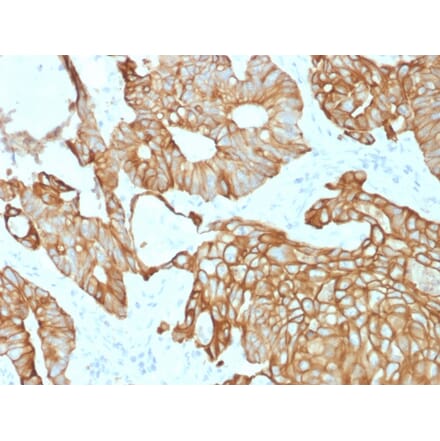 Immunohistochemistry - Anti-Cytokeratin 19 Antibody [rKRT19/800] (A249216) - Antibodies.com
