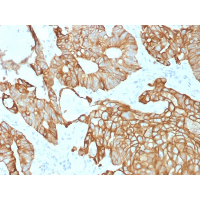Immunohistochemistry - Anti-Cytokeratin 19 Antibody [rKRT19/800] (A249216) - Antibodies.com