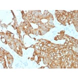 Immunohistochemistry - Anti-Cytokeratin 19 Antibody [rKRT19/800] (A249216) - Antibodies.com