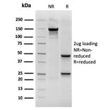 SDS-PAGE - Anti-Cytokeratin 19 Antibody [rKRT19/800] (A249217) - Antibodies.com