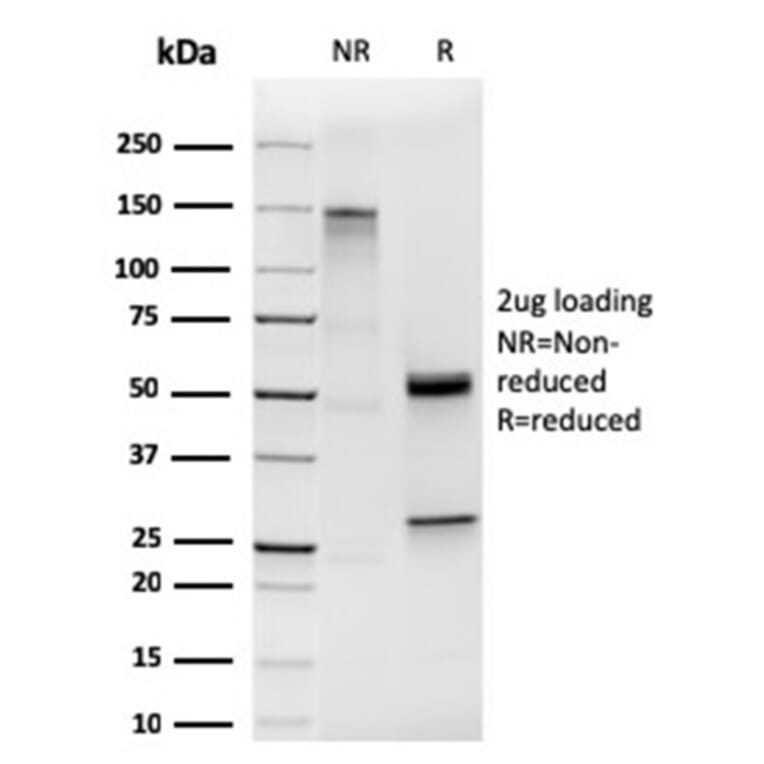 SDS-PAGE - Anti-Cytokeratin 19 Antibody [KRT19/1959R] (A249218) - Antibodies.com