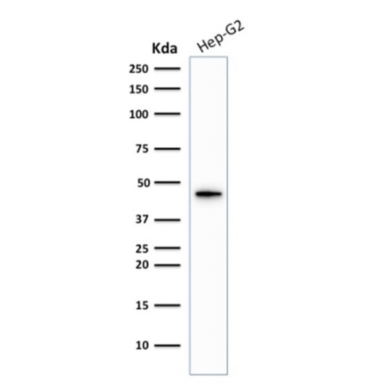 Western Blot - Anti-Cytokeratin 19 Antibody [KRT19/1959R] (A249218) - Antibodies.com