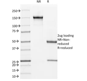 SDS-PAGE - Anti-L1CAM Antibody [UJ127] (A249218) - Antibodies.com
