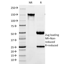 SDS-PAGE - Anti-L1CAM Antibody [SPM275] (A249219) - Antibodies.com