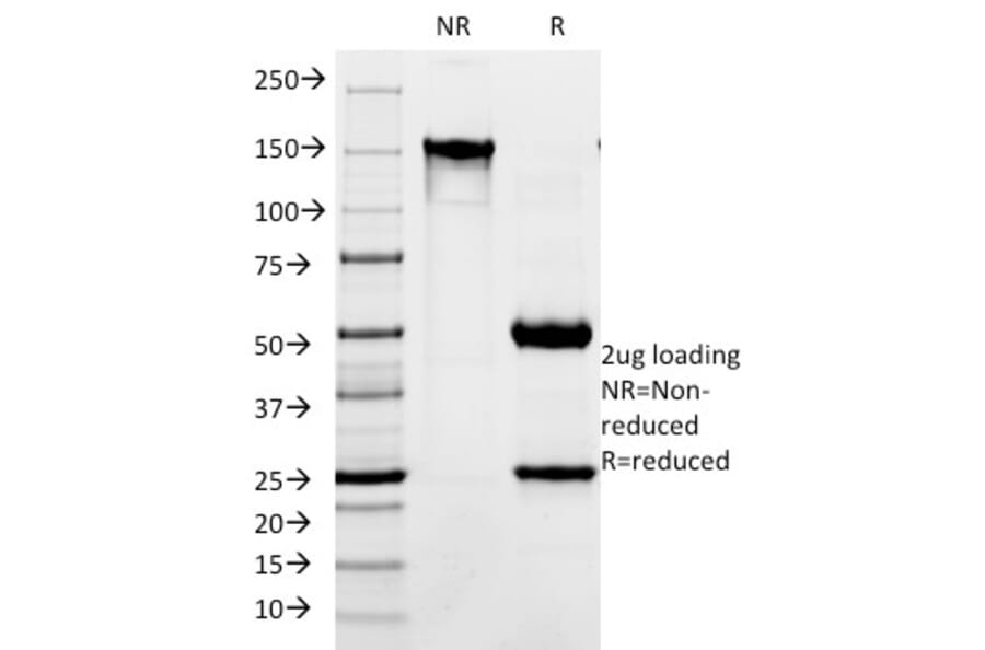 SDS-PAGE - Anti-L1CAM Antibody [SPM275] (A249219) - Antibodies.com