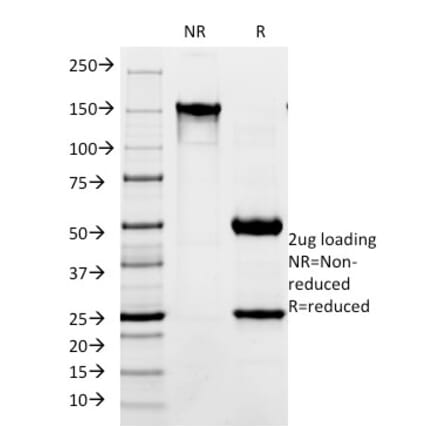 SDS-PAGE - Anti-L1CAM Antibody [SPM275] (A249219) - Antibodies.com