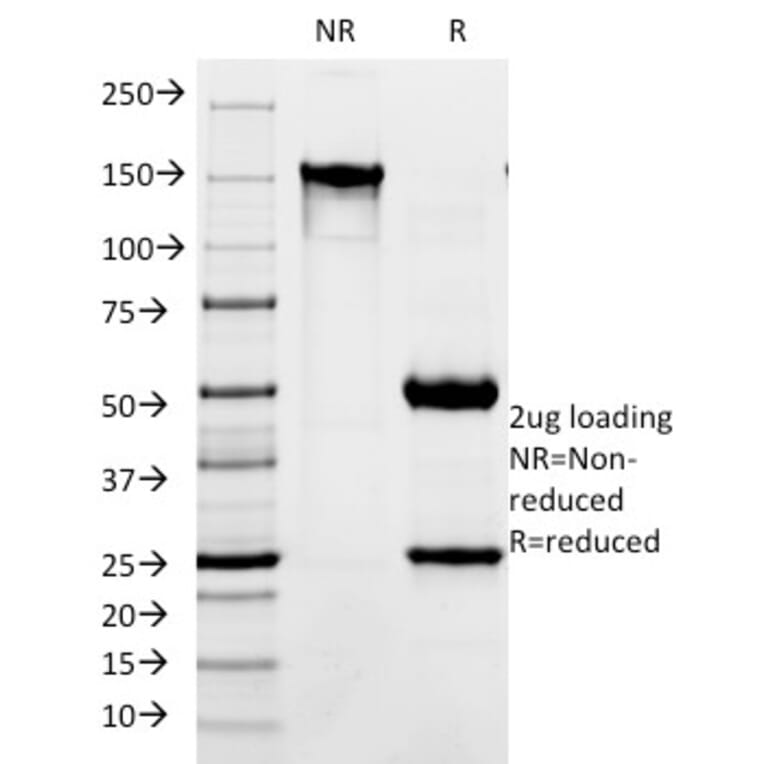 SDS-PAGE - Anti-L1CAM Antibody [SPM275] (A249219) - Antibodies.com