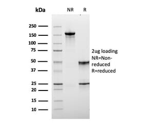 SDS-PAGE - Anti-Lymphocyte Activation Gene 3 Antibody [LAG3/3261] (A249221) - Antibodies.com
